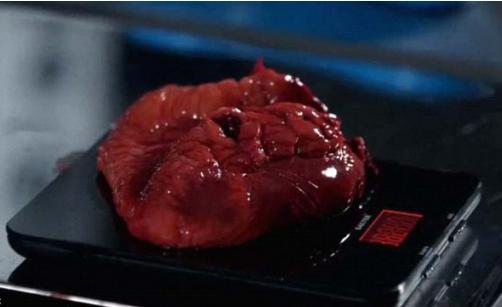 当奥斯本博士取出女尸的心脏时,肥胖带给人体的损害就一目