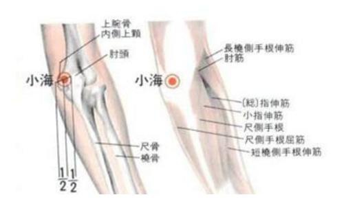 穴位的故事115小海:小指麻木