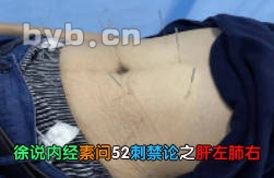 徐说内经素问52刺禁论之肝左肺右